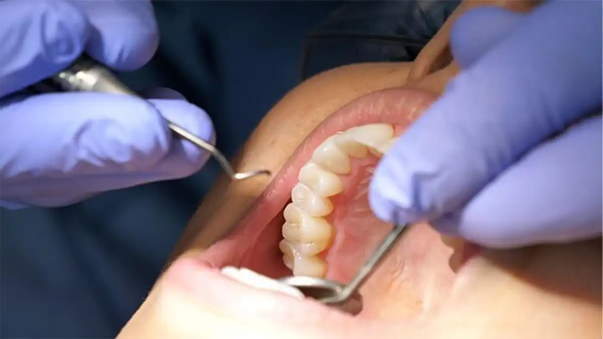 What's The Actual Difference Between Laser and Tray Teeth Whitening—And Why Should You Give a Floss Sheffield?